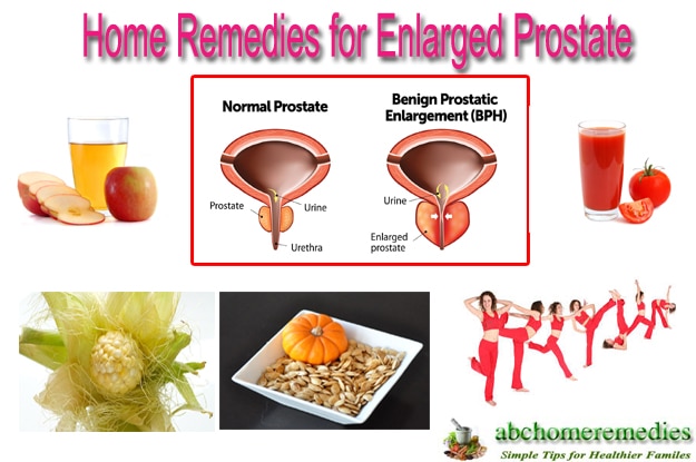 13 Outstanding Home Remedies for Enlarged Prostate  Abchomeremedies