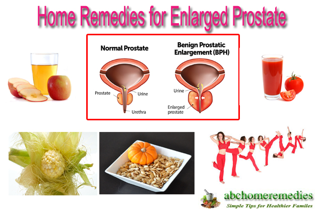 13 Outstanding Home Remedies for Enlarged Prostate ...