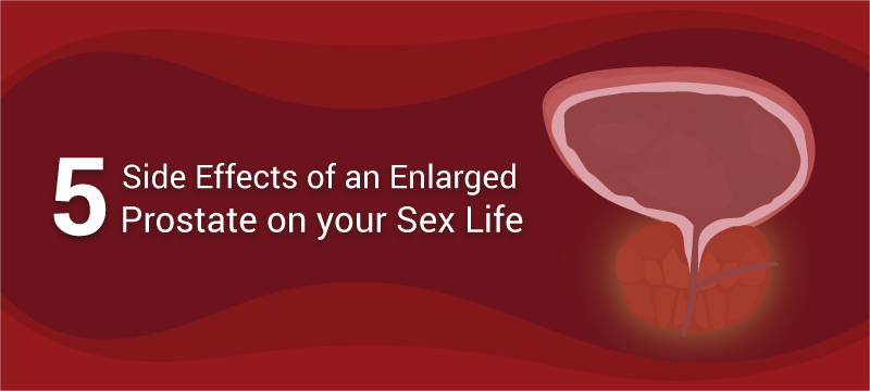 5 Side Effects of an Enlarged Prostate on your Sex Life