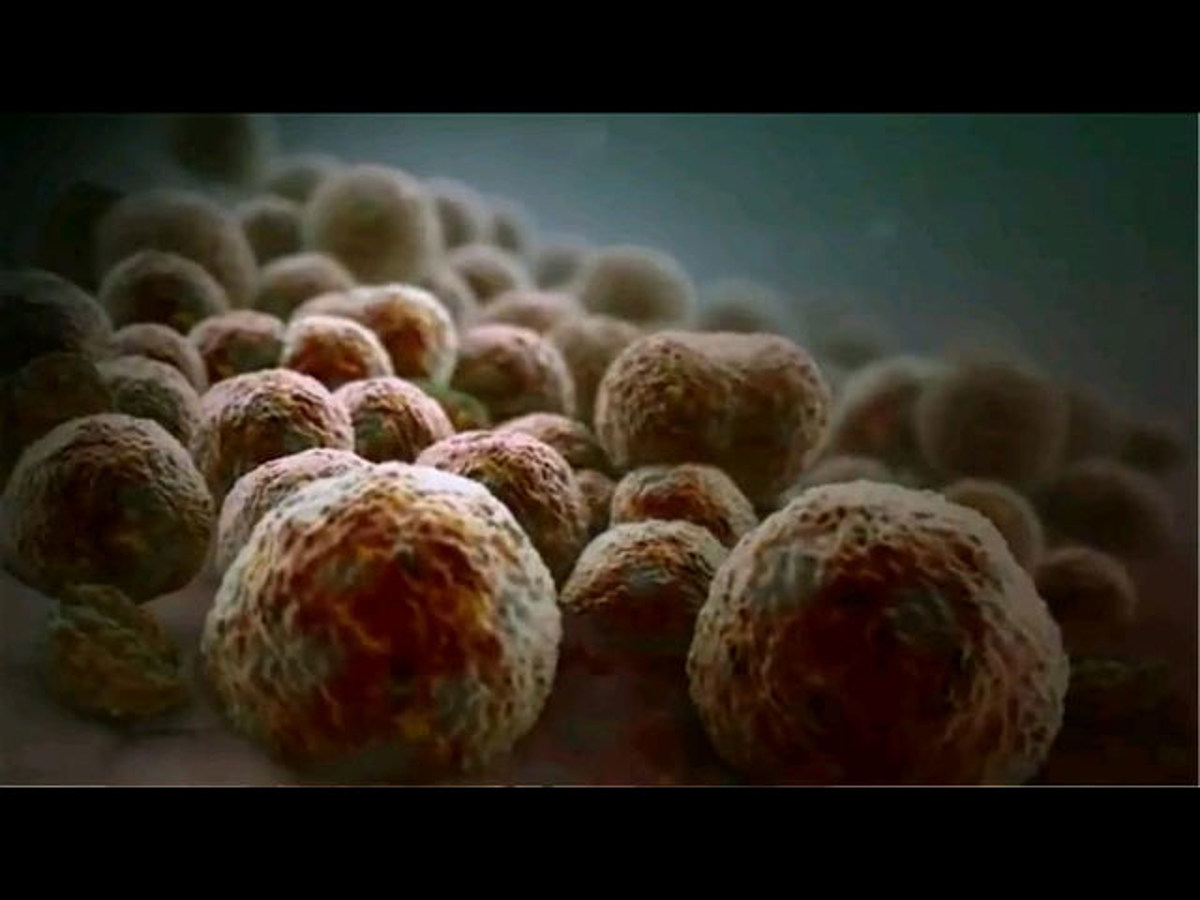 A Cure For Prostate Cancer? [Video]