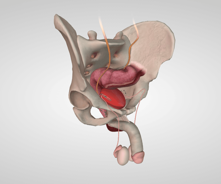 About Your Prostate Ablation Procedure