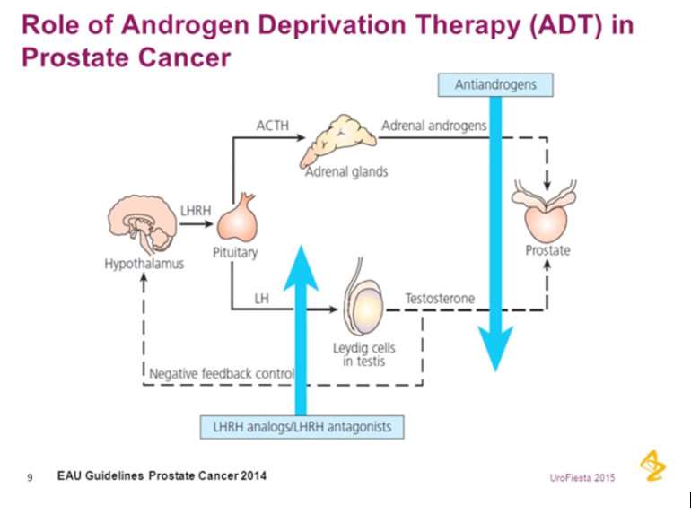 ADT, Apalutamide and Exercise in the Treatment of Prostate ...