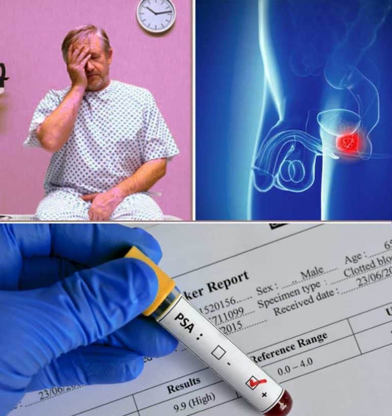 Best Way To Check Prostate Cancer