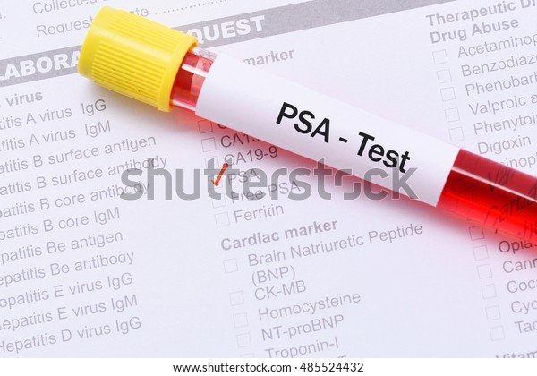 Blood Psa Test Tumor Marker Prostate Stock Photo (Edit Now) 485524432