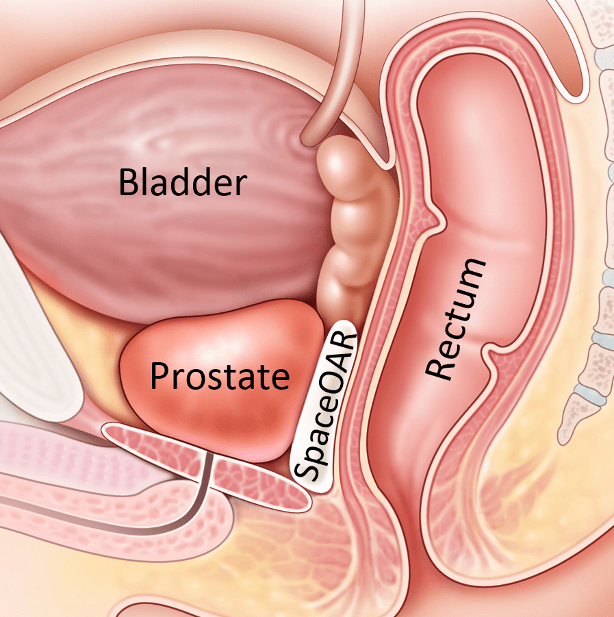 Do women have prostates?
