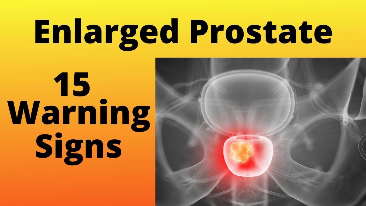 Enlarged Prostate (15 Warning Signs)