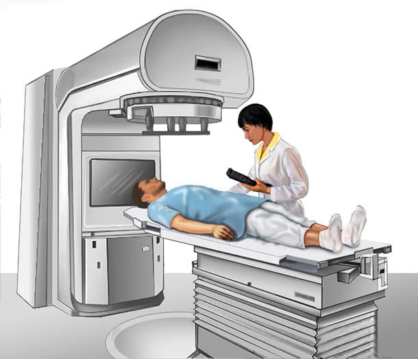 External Beam Radiation Therapy for Cancer â thailandcancerhelp.com