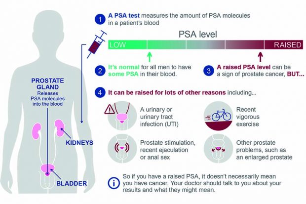 Guidance updated on PSA testing for prostate cancer