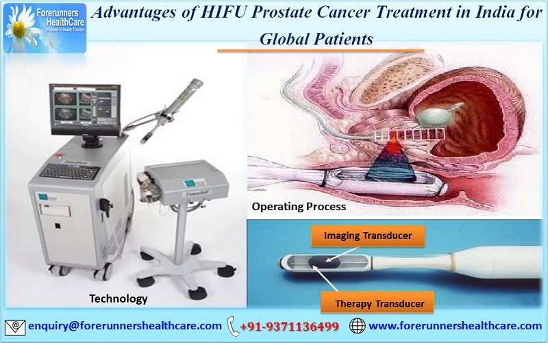 HIFU For Prostate Cancer Treatment in India