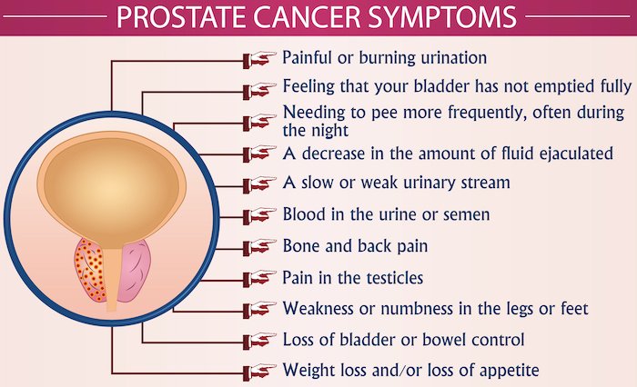 How Do You Know When You Have Prostate Cancer