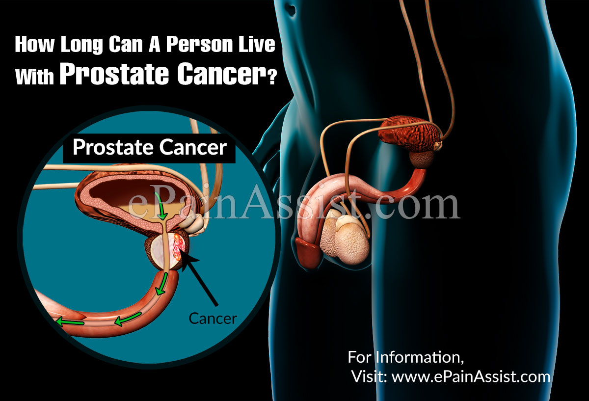 How Long Can I Live With Prostate Cancer