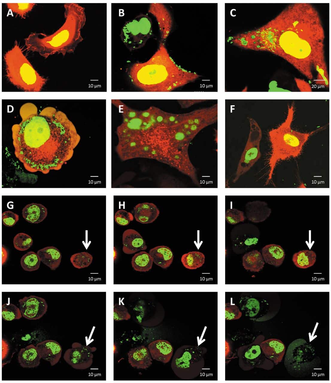Imaging the Different Mechanisms of Prostate Cancer Cell