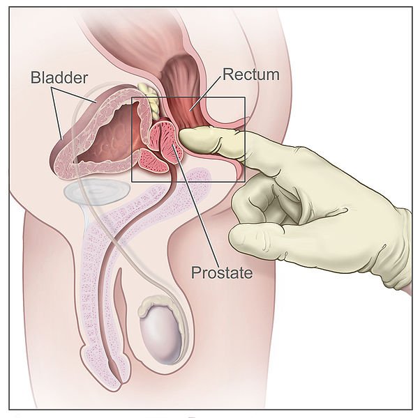 Is a prostate self exam something you can do safely and ...