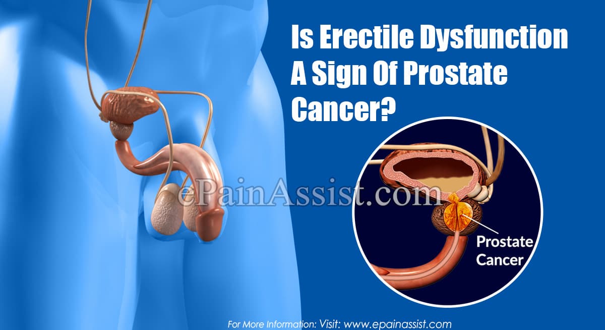 Is Erectile Dysfunction A Sign Of Prostate Cancer?