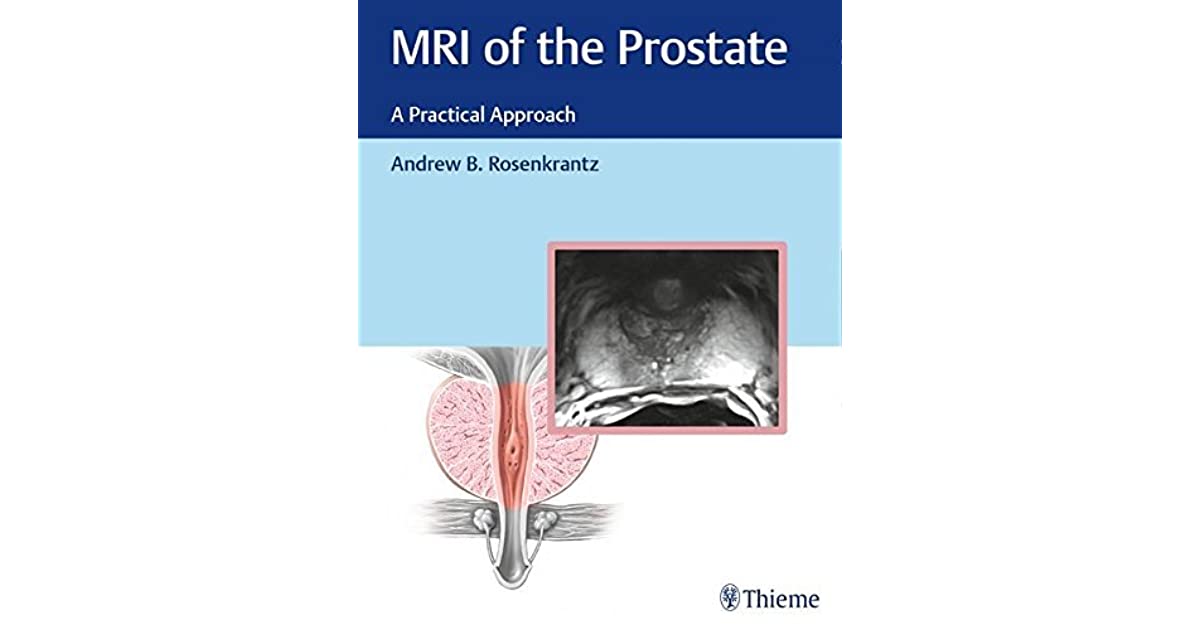 MRI of the Prostate: A Practical Approach by Andrew B ...
