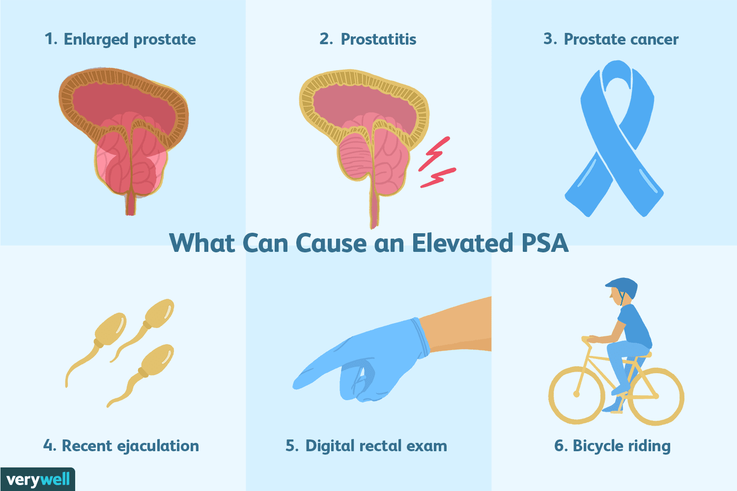Overview of the Prostate