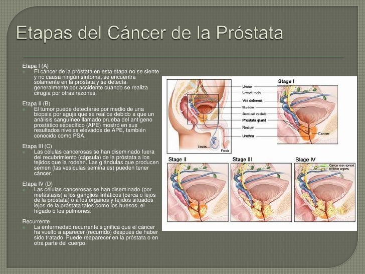 Prostata actualizacion 2012