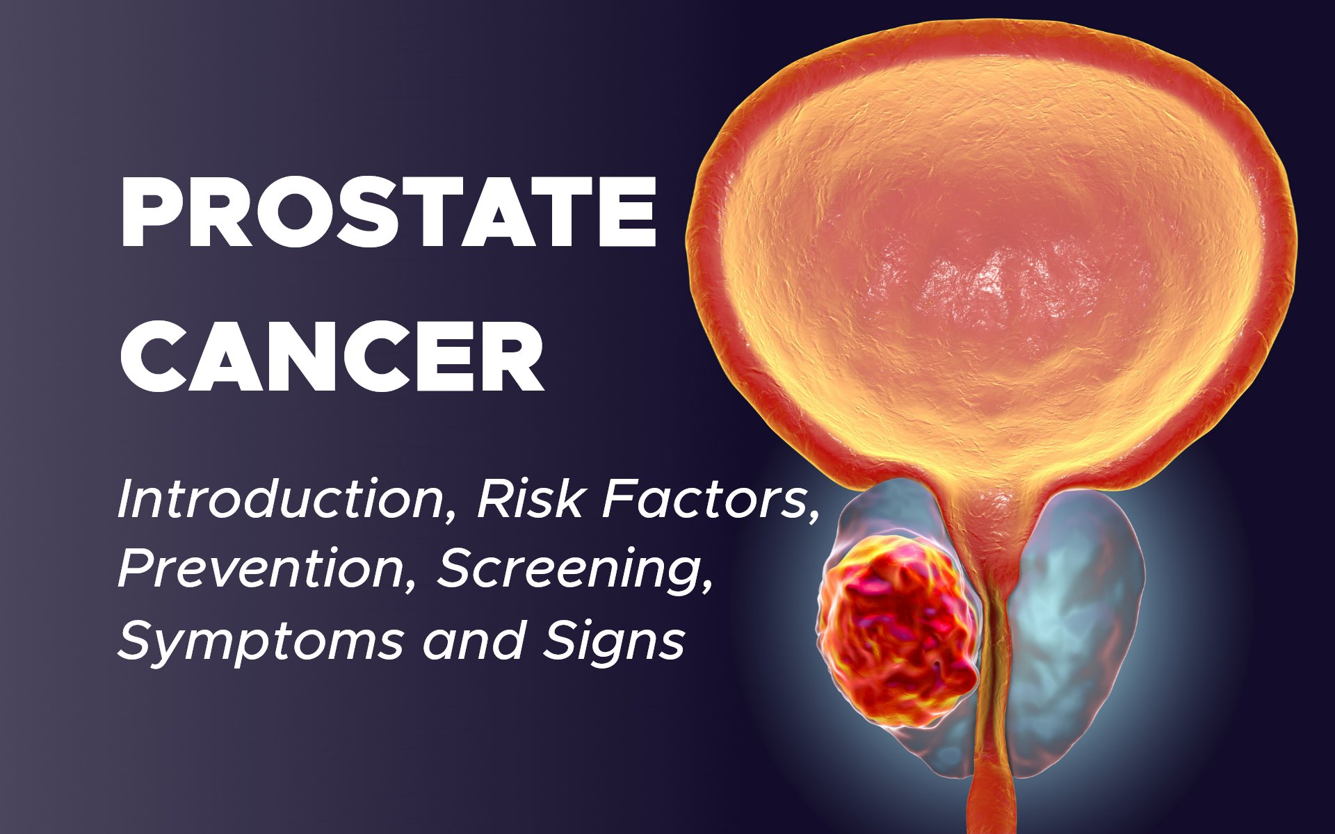 Prostate Cancer: Introduction, Risk Factors, Prevention, Screening ...