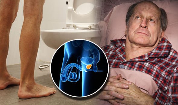 Prostate cancer: Seven symptoms of the disease revealed