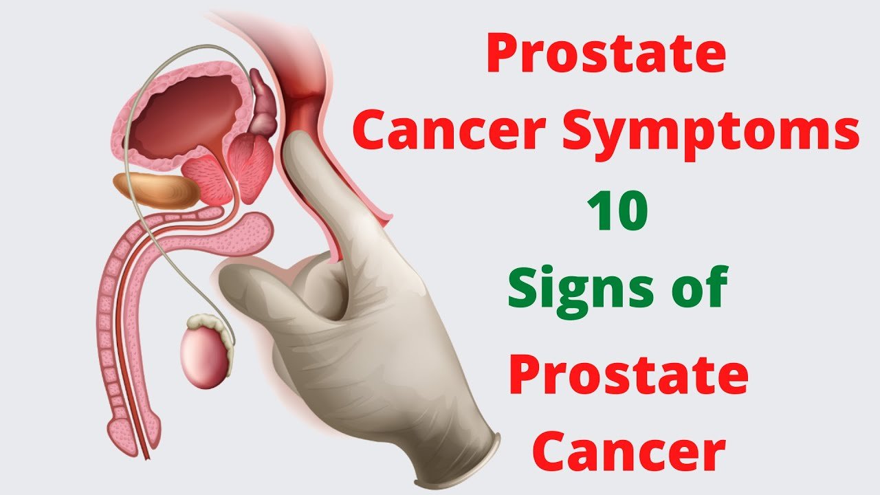 Prostate Cancer Symptoms  10 Signs of Prostate Cancer