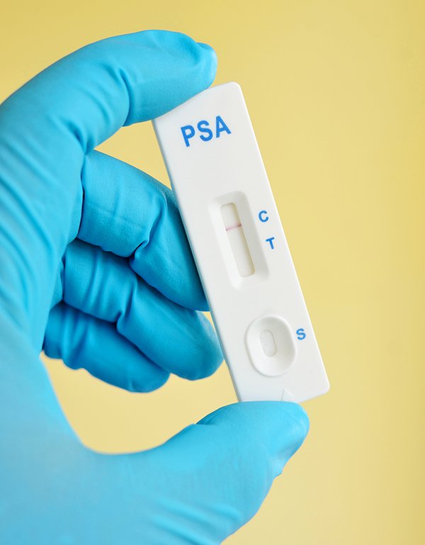 Prostate Cancer Symptoms? PSA Test Is Only Part of the ...