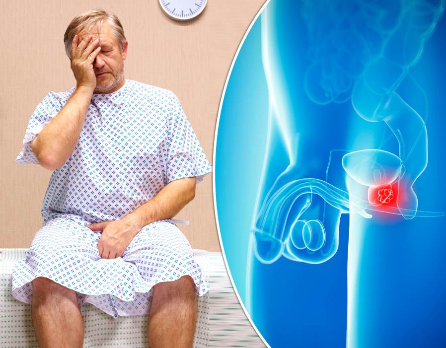 Prostate cancer symptoms