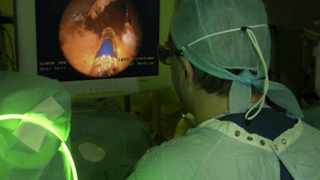 Prostate laser therapy recommended to NHS