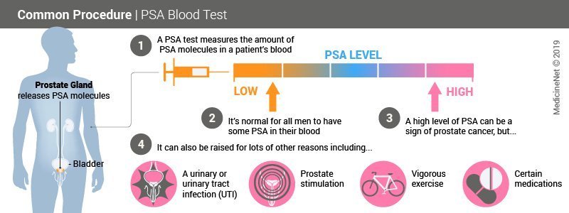 Prostate Specific Antigen (PSA) Test, Results, Levels &  Ranges