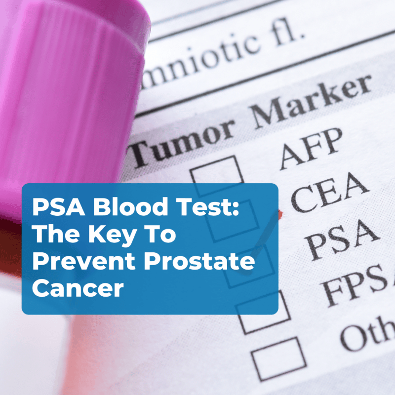 PSA Blood Test: The Key To Prevent Prostate Cancer