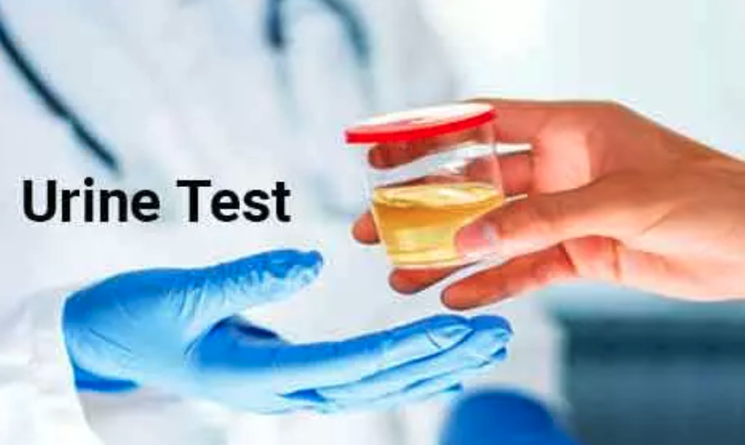 Researchers Develop An Accurate Urine Test For Prostate Cancer ...