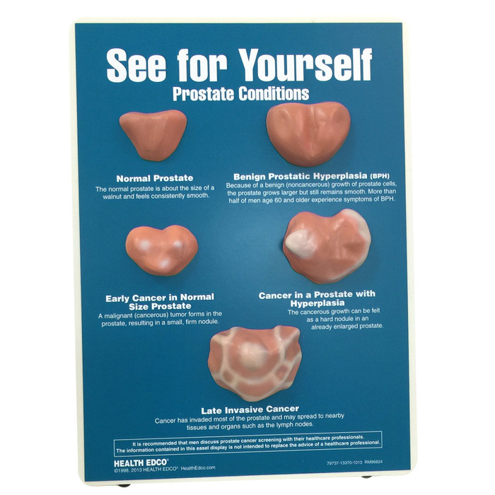 See For Yourself: Prostate Conditions Easel Display
