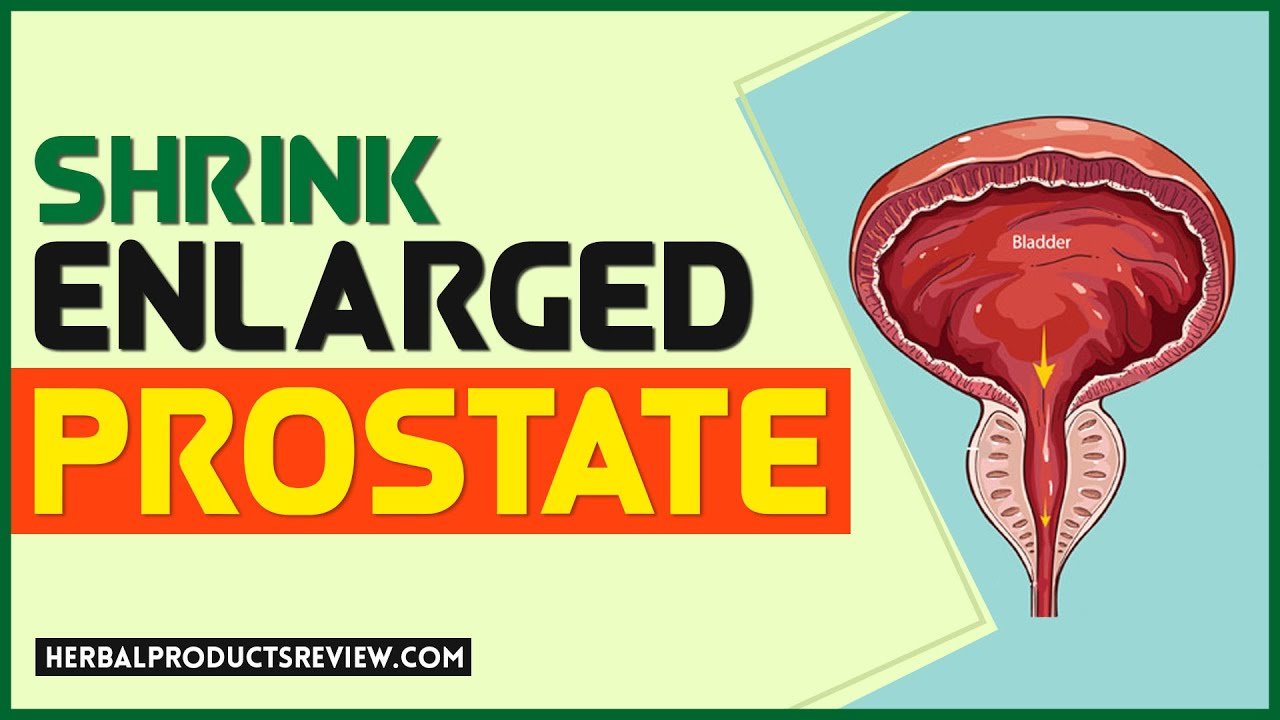 Shrink Enlarged Prostate, Natural Supplements for Prostate ...