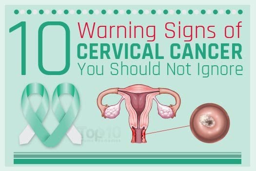 Signs Of Cervical cancer Dizziness