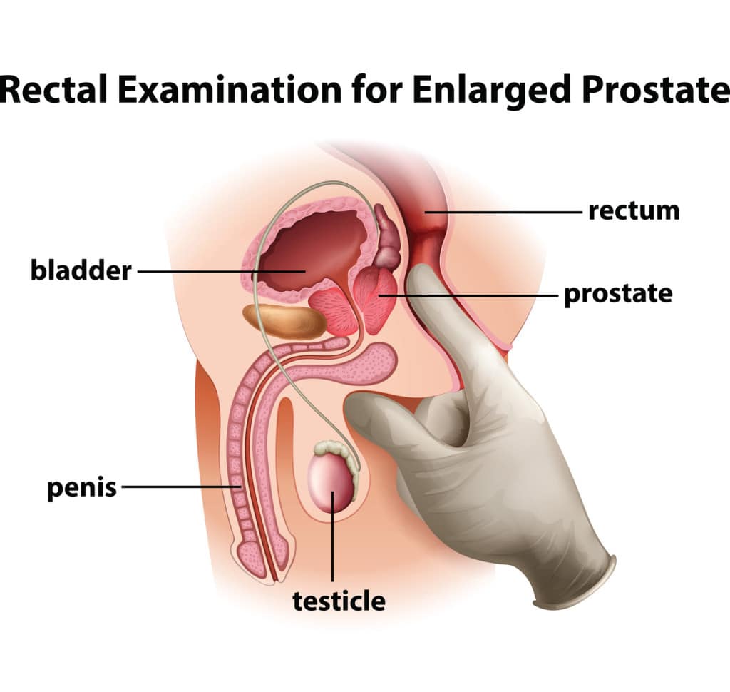 Support A Healthy Prostate Function With Prostacet