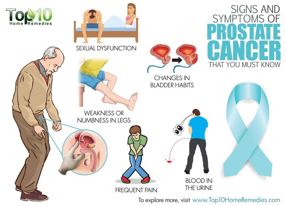 What Are The Symptoms Of Prostrate Cancer
